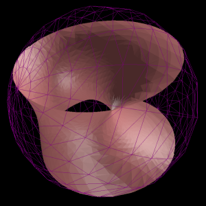 Stereographic projection of a cone